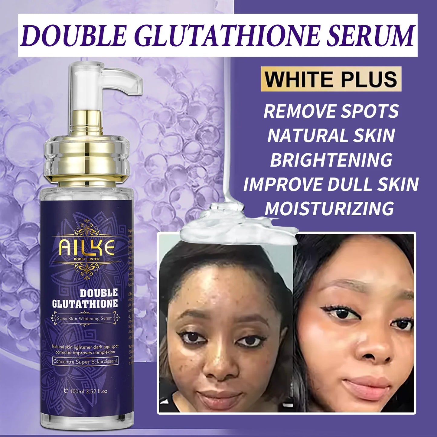 AILKE Glutathione 5-in-1 Women Skin Care Kit, With Body Lotion,  Serum, Dark Spot Removal Cream, Body Cream, Brightening Soap